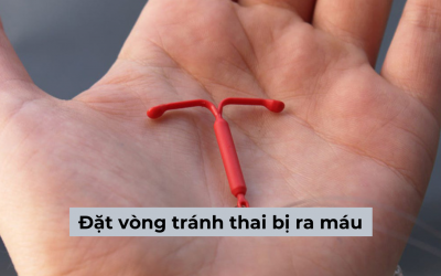 Đặt vòng tránh thai bị ra máu liệu có nguy hiểm không?