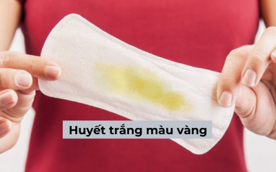 Tìm hiểu huyết trắng màu vàng: Nguyên nhân, tác hại và cách khắc phục