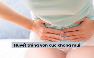Huyết trắng vón cục không mùi là gì, làm sao để khắc phục tình trạng này?