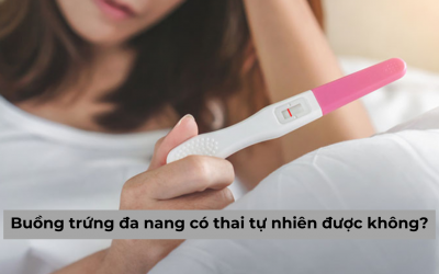 [Chuyên gia giải đáp] Buồng trứng đa nang có thai tự nhiên được không?