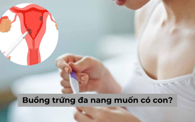 [Giải đáp thắc mắc] Buồng trứng đa nang muốn có con phải làm gì?