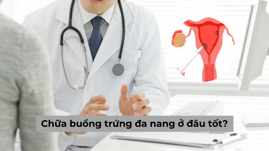 Mách chị em biết chữa buồng trứng đa nang ở đâu tốt