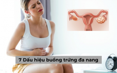 7 Dấu hiệu buồng trứng đa nang điển hình và cách chữa hiệu quả
