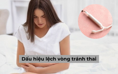 Những dấu hiệu lệch vòng tránh thai nguy hiểm mà chị em cần lưu ý