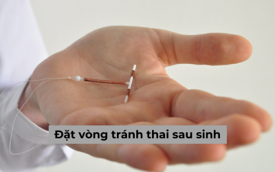 Đặt vòng tránh thai sau sinh và những vấn đề chị em cần biết