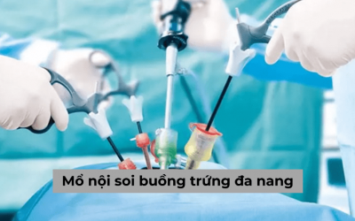 Mổ nội soi buồng trứng đa nang có nguy hiểm hay không?