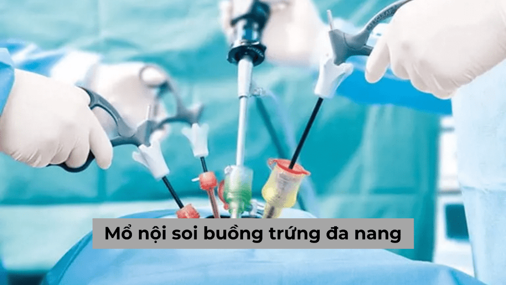 Mổ nội soi buồng trứng đa nang có nguy hiểm hay không?