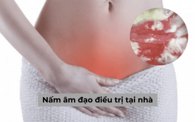 [Giải đáp thắc mắc] Nấm âm đạo điều trị tại nhà có thật sự hiệu quả?