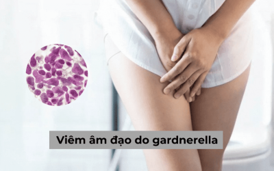 Dấu hiệu, nguyên nhân và cách điều trị viêm âm đạo do gardnerella