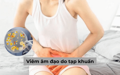 [Giải đáp] Tất tần tật về viêm âm đạo do tạp khuẩn