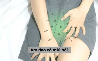 Tìm hiểu nguyên nhân và cách chữa âm đạo có mùi hôi hiệu quả
