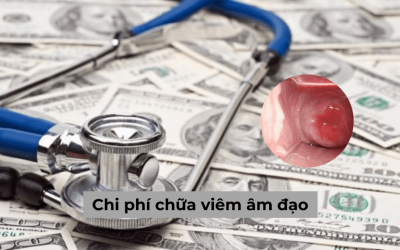 [Giải đáp thắc mắc] Chi phí chữa viêm âm đạo liệu có đắt không?