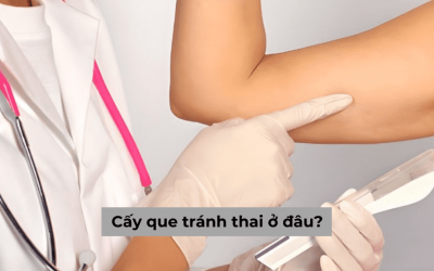 Tìm hiểu cấy que tránh thai ở đâu uy tín, đảm bảo độ an toàn cao
