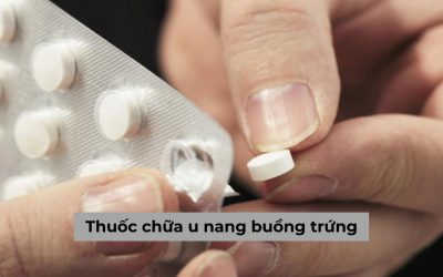 Thuốc chữa u nang buồng trứng liệu có chữa khỏi bệnh được không?