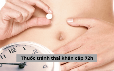 Thuốc tránh thai khẩn cấp 72h và những thông tin cần biết trước khi dùng