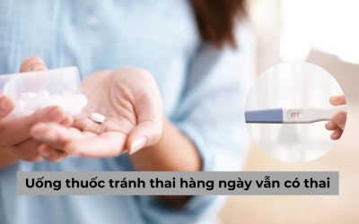 [Giải đáp thắc mắc] Uống thuốc tránh thai hàng ngày vẫn có thai?