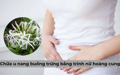 Có hay không nên chữa u nang buồng trứng bằng trinh nữ hoàng cung?