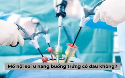 Mổ nội soi u nang buồng trứng có đau không? Bao lâu hồi phục?