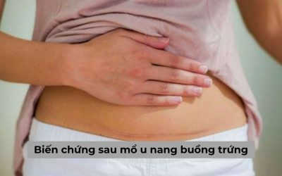 [Giải đáp thắc mắc] Biến chứng sau mổ u nang buồng trứng là gì?