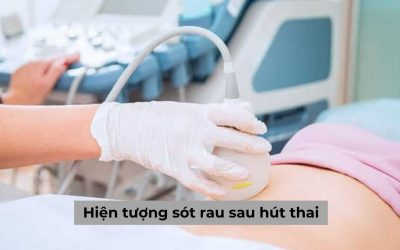 Cập nhật thông tin từ A – Z về hiện tượng sót rau sau hút thai