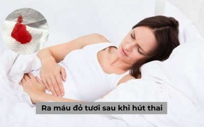 Ra máu đỏ tươi sau khi hút thai có phải hiện tượng nguy hiểm
