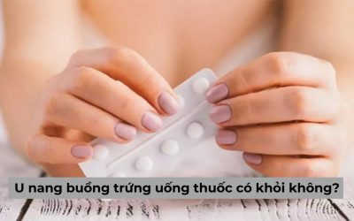 Giải đáp của chuyên gia: U nang buồng trứng uống thuốc có khỏi không?