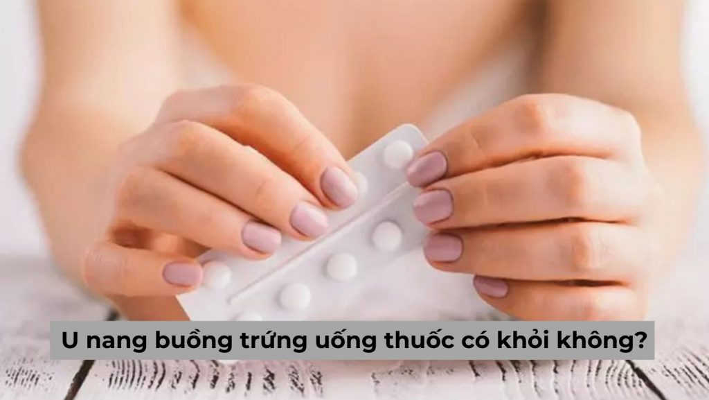 Giải đáp của chuyên gia: U nang buồng trứng uống thuốc có khỏi không?