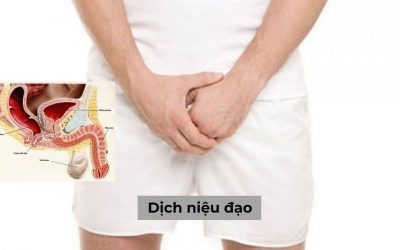 Dịch niệu đạo và một số những bệnh lý liên quan cần biết