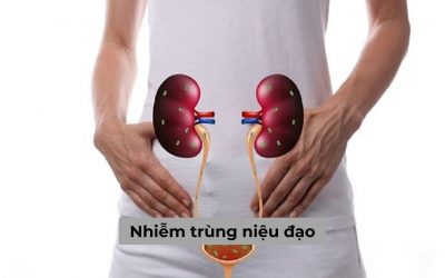 Nhiễm trùng niệu đạo và những thông tin bạn không nên bỏ lỡ!