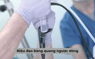 [Cập nhật chi tiết] Chụp niệu đạo bàng quang ngược dòng
