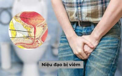 Niệu đạo bị viêm là bệnh gì, cách chữa như thế nào?