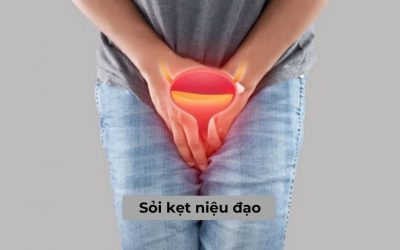 Tìm hiểu những thông tin cần biết về bệnh sỏi kẹt niệu đạo