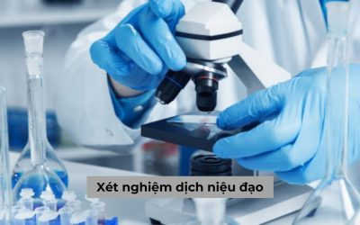 Xét nghiệm dịch niệu đạo và những điều cần biết [Giải đáp]