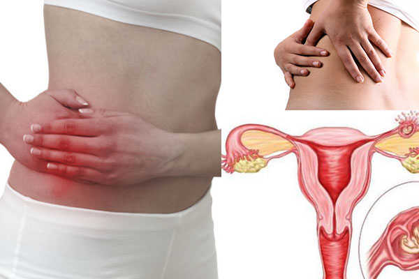 Đau bụng dưới bên trái sau khi hút thai