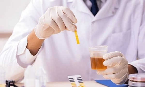 Vì sao cần xét nghiệm tế bào biểu mô của niệu đạo trong nước tiểu?