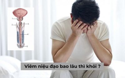 Người mắc bệnh viêm niệu đạo bao lâu thì khỏi, điều trị như thế nào?