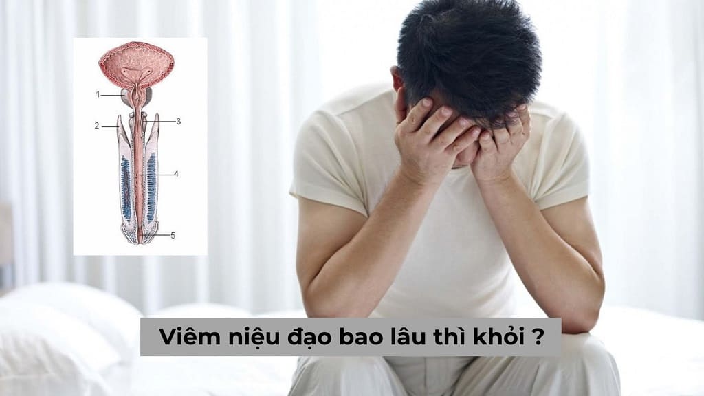 Người mắc bệnh viêm niệu đạo bao lâu thì khỏi, điều trị như thế nào?