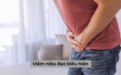Viêm niệu đạo biểu hiện như thế nào trên cơ thể người bệnh?