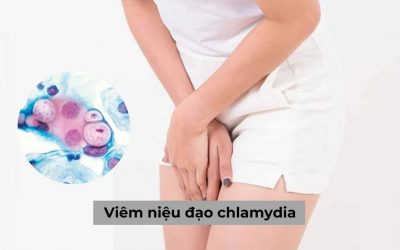 Thế nào là viêm niệu đạo Chlamydia: Biểu hiện, tác hại và cách chẩn đoán