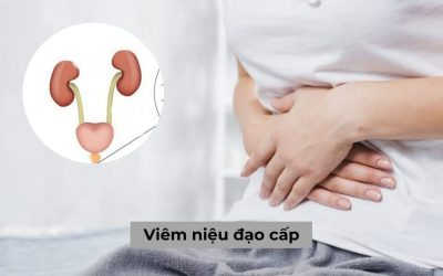 Viêm niệu đạo cấp: Nguyên nhân, dấu hiệu và cách điều trị hiệu quả