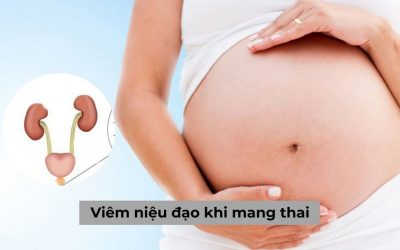 Viêm niệu đạo khi mang thai và những điều bạn nên biết