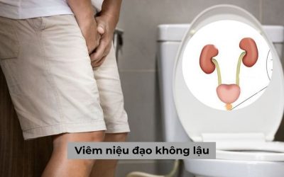 Viêm niệu đạo không lậu là gì? Triệu chứng & Cách điều trị dứt điểm