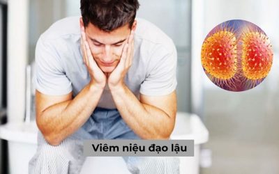 Thế nào là viêm niệu đạo lậu: Nguyên nhân, triệu chứng và cách điều trị