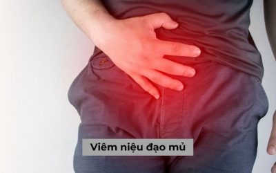 Viêm niệu đạo mủ có nguy hại không, làm sao để khắc phục hiệu quả?