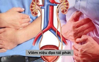 Viêm niệu đạo tái phát: Nguyên nhân và cách điều trị dứt điểm