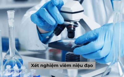 Giải đáp: Xét nghiệm viêm niệu đạo để làm gì, cần lưu ý những gì?
