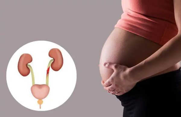 Dấu hiệu viêm niệu đạo khi mang thai