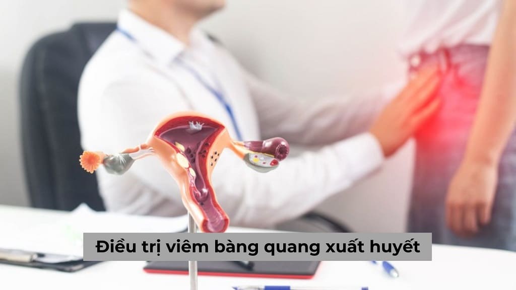 Chuyên gia chia sẻ tìm hiểu cách điều trị viêm bàng quang xuất huyết