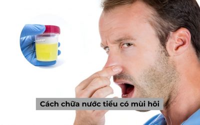 Cách chữa nước tiểu có mùi hôi hiệu quả cùng chuyên gia