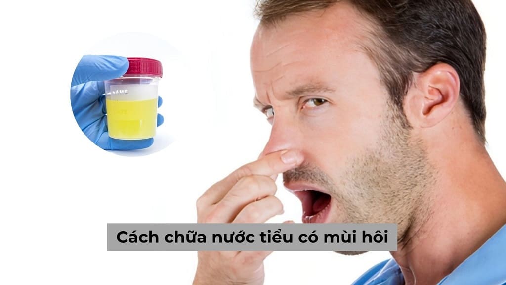 Cách chữa nước tiểu có mùi hôi hiệu quả cùng chuyên gia